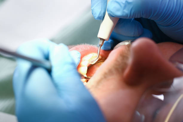 Best Emergency Dental Care for Broken or Chipped Teeth in Tulia, TX