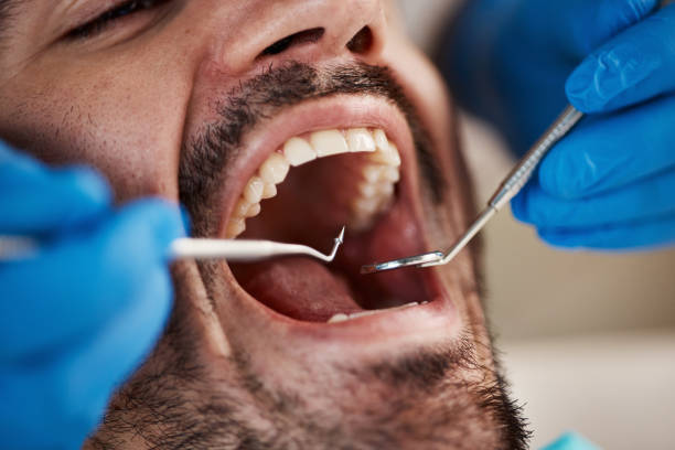 Best Emergency Gum Treatment in Tulia, TX